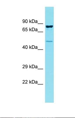 Polyclonal Rabbit anti-Human CCDC121 Antibody (aa179-228, WB)