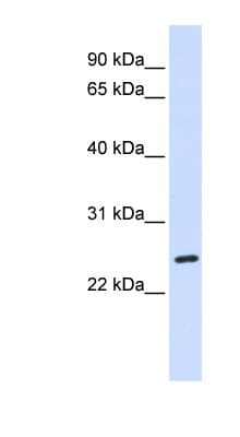 BAD Antibody (C-Terminus)