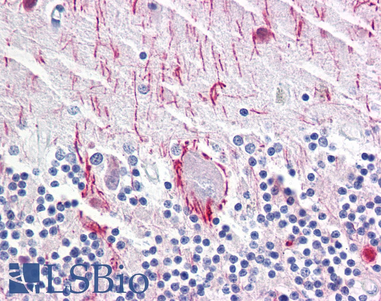 IHC-plus™ Monoclonal Mouse anti-Human NEFH / NF-H Antibody (clone RNF404, IHC, WB)