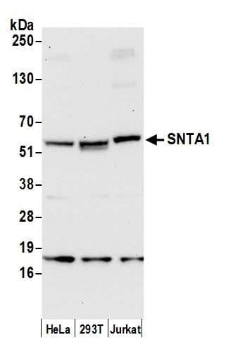 SNTA1 / Syntrophin Alpha 1 Antibody (aa50-100)