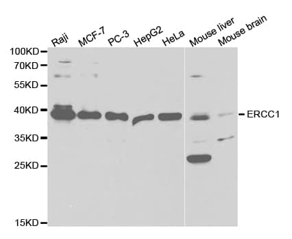 Polyclonal Rabbit anti-Human ERCC1 Antibody (IHC, IF, WB)