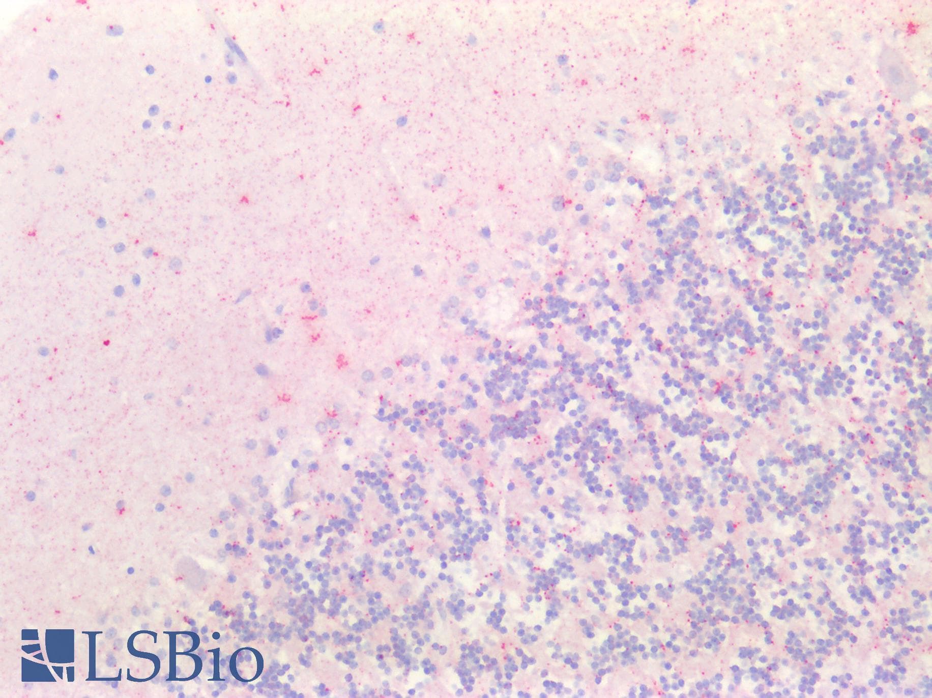 PathPlus™ NGF Antibody (aa33-82)