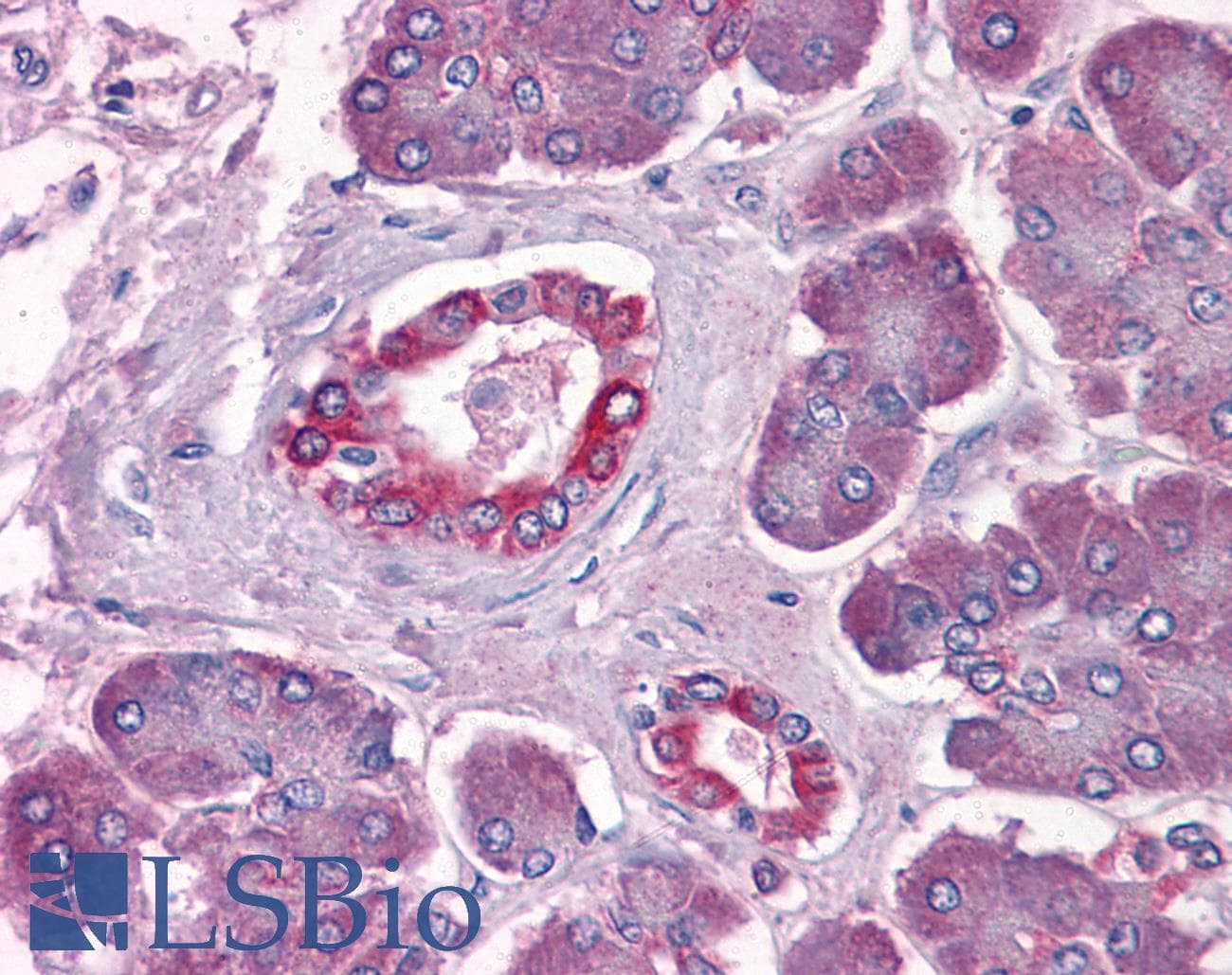 IHC-plus™ DUSP6 / MKP3 Antibody (clone 3G2)