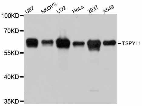 Polyclonal Rabbit anti-Human TSPYL1 Antibody (WB)
