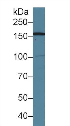 AIM1 Antibody (aa1502-1719, PE)
