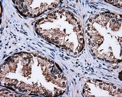 Monoclonal Mouse anti-Human MCL1 / MCL 1 Antibody (clone OTI4B7, IHC, IF, WB)
