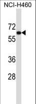 Polyclonal Rabbit anti-Human UGT2B11 Antibody (aa429-458, WB)