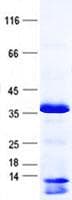Human PPM1M Protein (Recombinant His, N-Terminal)