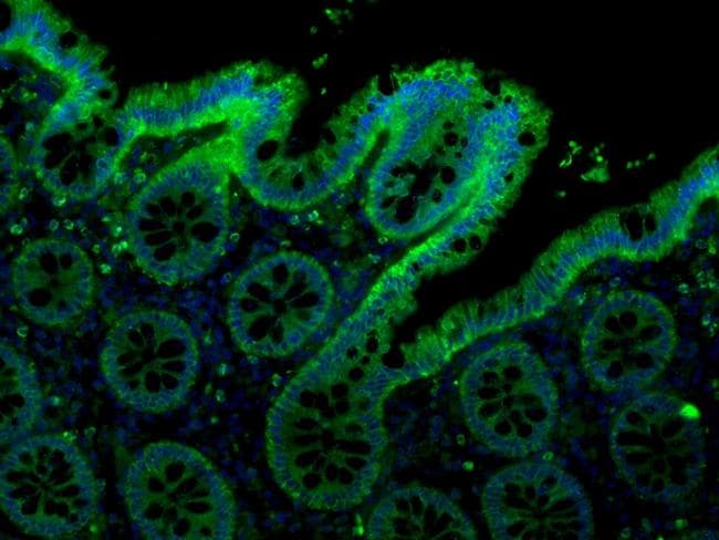 CLDN4 / Claudin 4 Antibody (C-Terminus, clone 3E2C1)