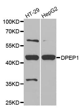 Polyclonal Rabbit anti-Human Renal Dipeptidase / DPEP1 Antibody (WB)