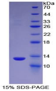 Human HMGN1 / HMG14 Protein (Recombinant His-T7)