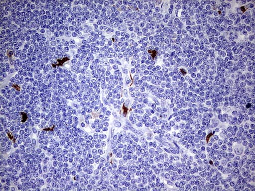 S100A9 / MRP14 Antibody (clone UMAB173)