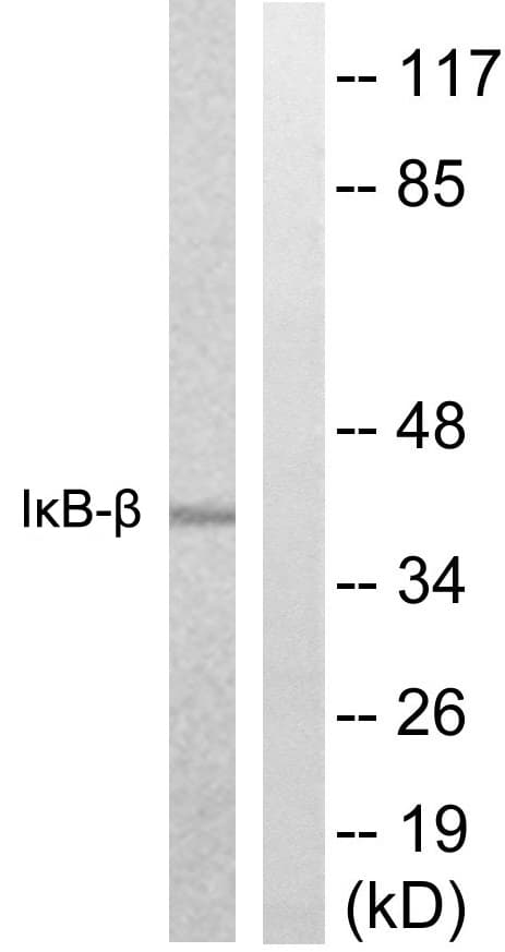 NFKBIB / IKB Beta / IKBB Antibody (aa4-53)