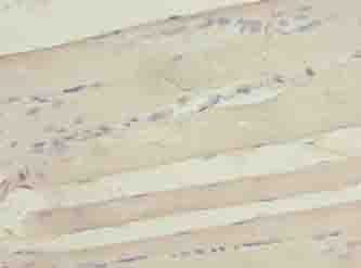 SEPW1 / Selenoprotein W Antibody