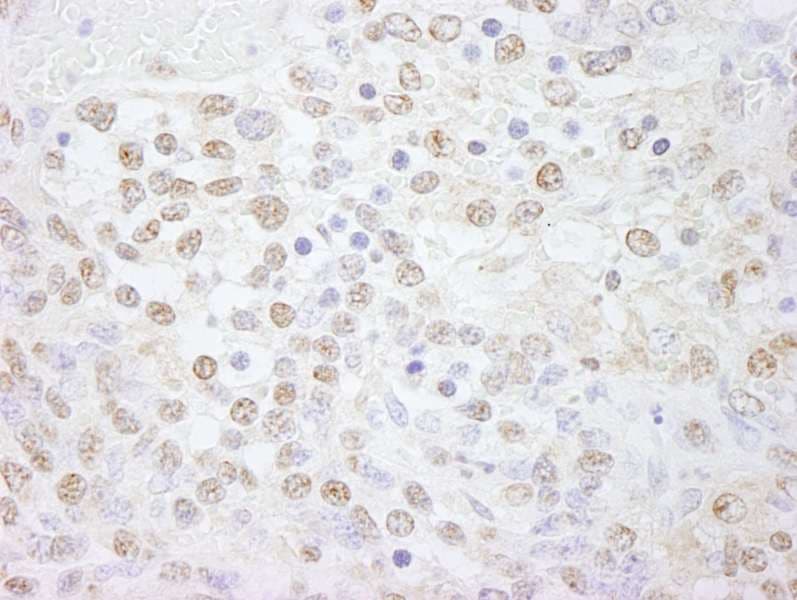 POLL / DNA Polymerase Lambda Antibody (aa525-575)