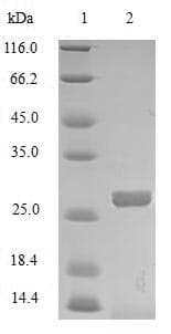 Cow MBL Protein (Recombinant 10His, N-terminus)