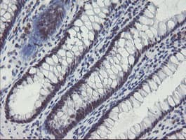 SENP2 Antibody (aa139-523, clone OTI3F5, Carrier-free)