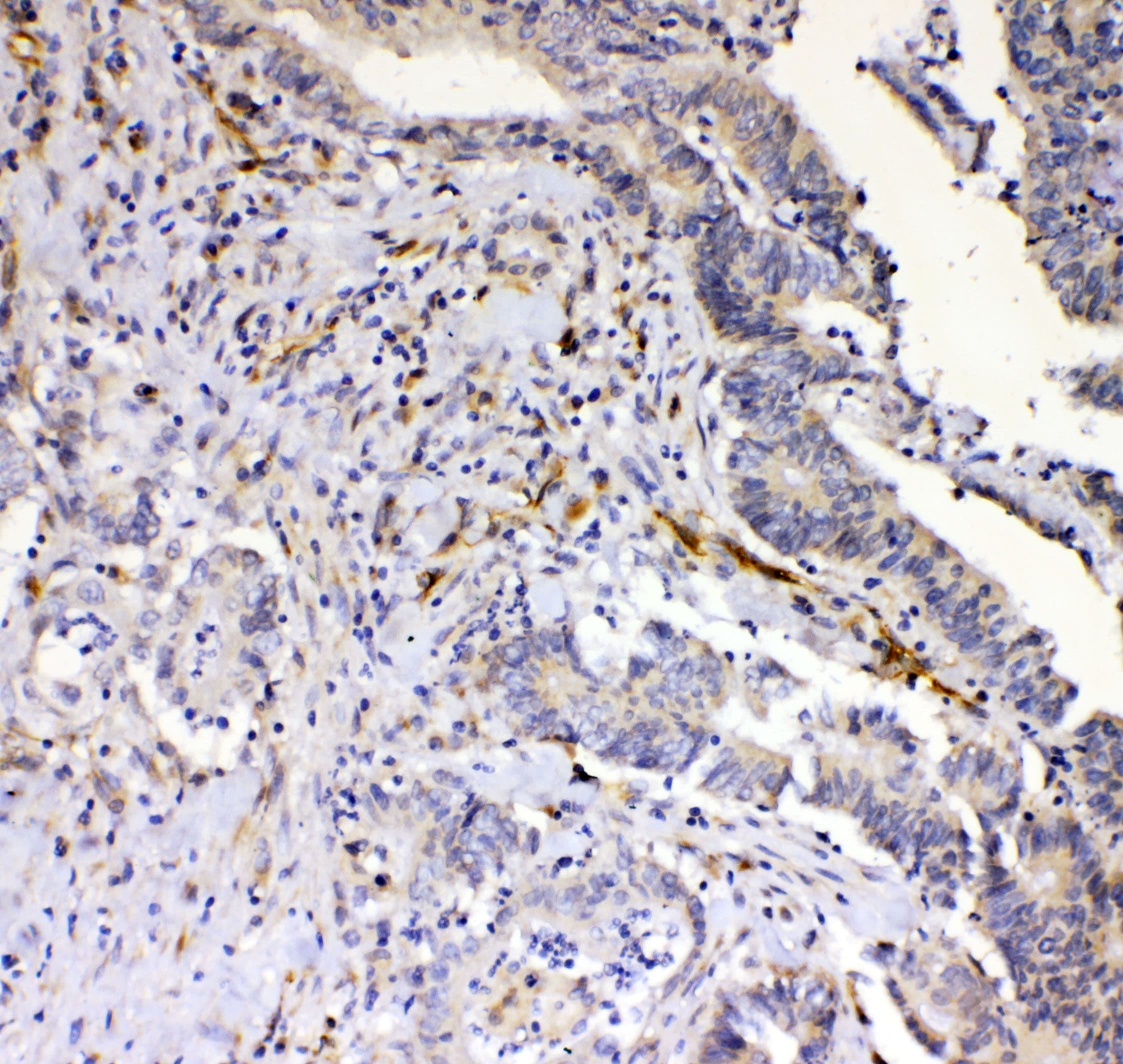 Polyclonal Rabbit anti-Human CD144 / CDH5 / VE Cadherin Antibody (WB)