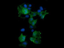 Monoclonal Mouse anti-Human MAP2K3 / MEK3 / MKK3 Antibody (clone OTI2G3, IF, WB)