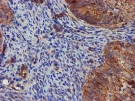 EPN2 Antibody (clone OTI1C5, Carrier-free)