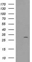 CTDSP1 / SCP1 Antibody (clone OTI1B5)