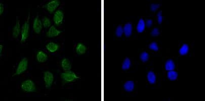 CHD3 Antibody (clone 2G4)
