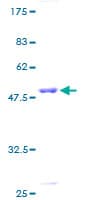 Human CBX5 / HP1 Alpha Protein (Recombinant GST)
