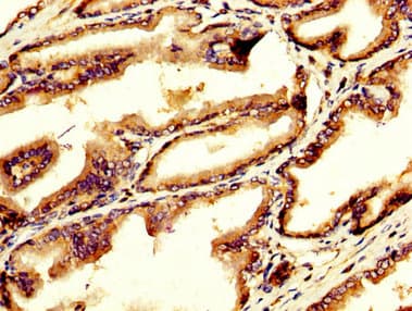 GDF10 / BMP3B Antibody