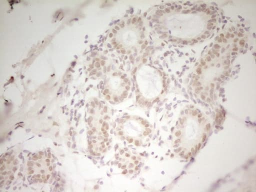 HMG20A Antibody (aa1-281, clone OTI5E3)