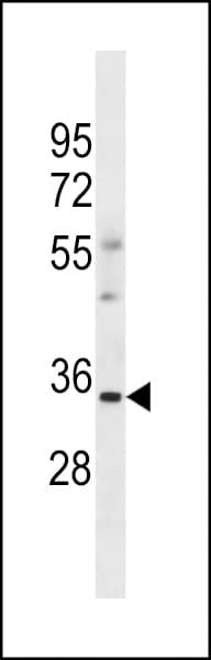 OR6S1 Antibody (aa281-310)
