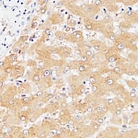 Polyclonal Rabbit anti-Human LILRA3 / CD85e Antibody (IHC, WB)
