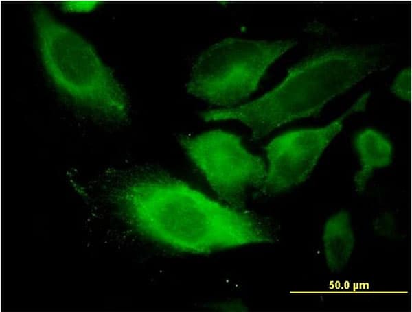 TSSC1 Antibody (clone 2H5)