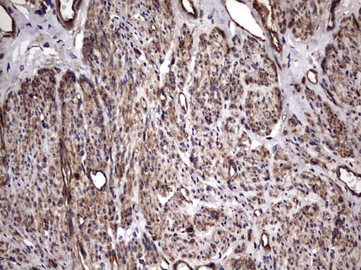 KRT7 / CK7 / Cytokeratin 7 Antibody (clone OTI2A2)