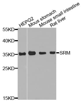 Polyclonal Rabbit anti-Human SRM / Spermidine Synthase Antibody (WB)