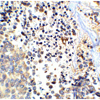 APP / Beta Amyloid Precursor Antibody