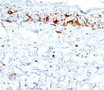 CD1A Antibody (clone C1A/711, Ready-to-Use)