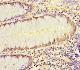 Polyclonal Rabbit anti-Human L1TD1 Antibody