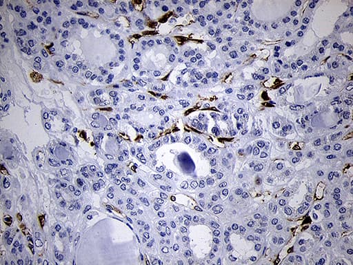 FSCN1 / Fascin Antibody (clone OTI3D2)