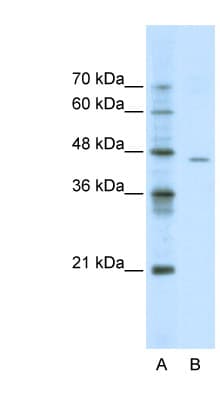 ACCN4 / ASIC4 Antibody (aa121-170)