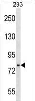 JADE3 / PHF16 Antibody (aa779-806)