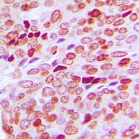 Polyclonal Rabbit anti-Human SPIN / SPIN1 Antibody (Internal, IHC, IF, WB)