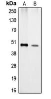 IHC-plus™ Polyclonal Rabbit anti-Human CPA1 / Carboxypeptidase A Antibody (Internal, IHC, WB)