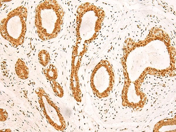 ZNF471 Antibody