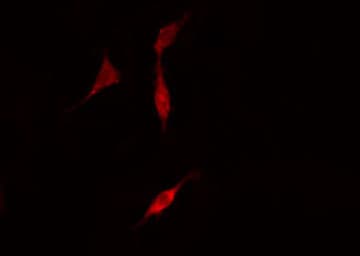 CLDN5 / Claudin 5 Antibody