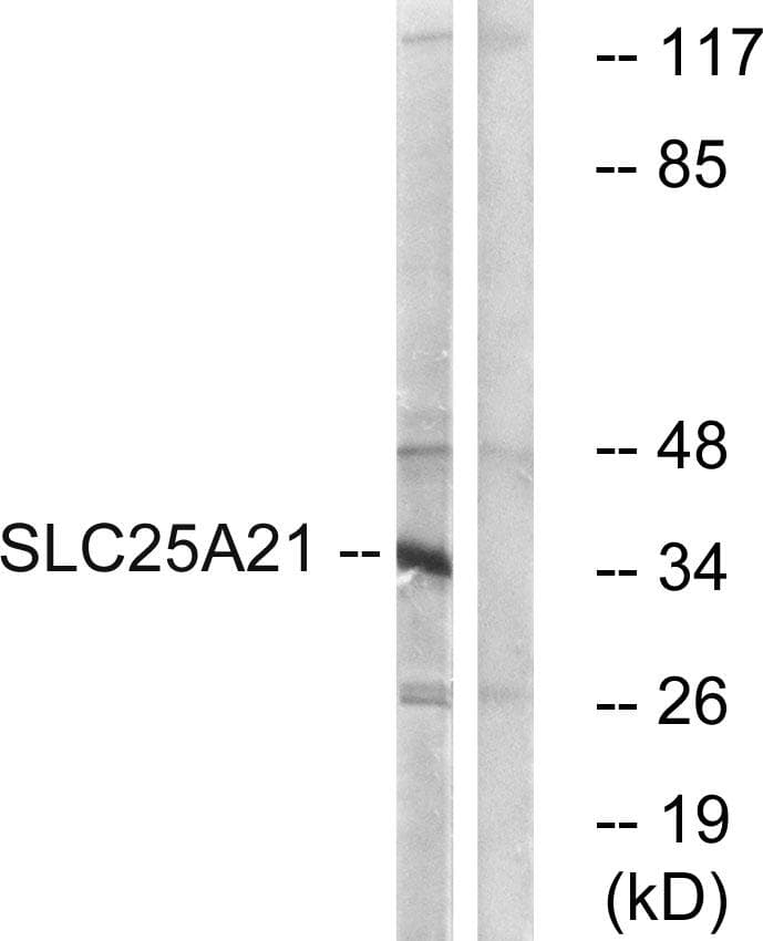 Polyclonal Rabbit anti-Human SLC25A21 / ODC1 Antibody (IHC, WB)