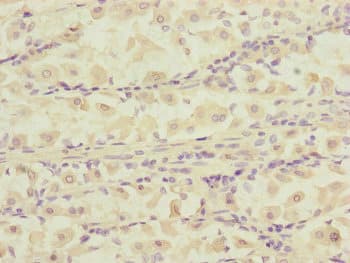 Polyclonal Rabbit anti-Human DCTN6 / Dynactin 6 Antibody (IHC, WB)