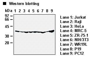 DNAJB1 / Hsp40 Antibody (clone 2E1)