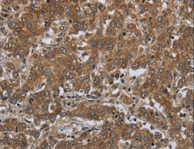 GABRB1 Antibody