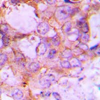 CASP6 / Caspase 6 Antibody (Internal)