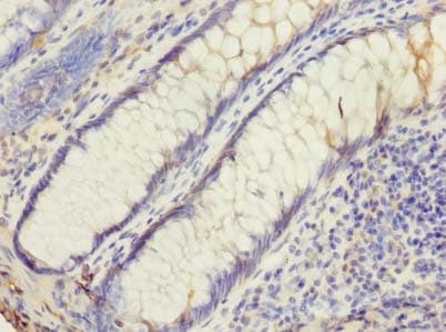 Polyclonal Rabbit anti-Human UBE2G2 Antibody (IHC, WB)